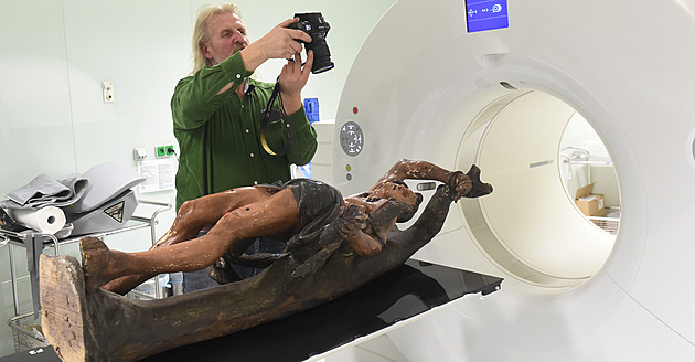 Barokní socha skončila na tomografii, ozářili ji víc než pacienty