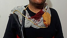 Zkrvavený �átek jednoho z demonstrant�, který vy�el do ulic protestovat proti...