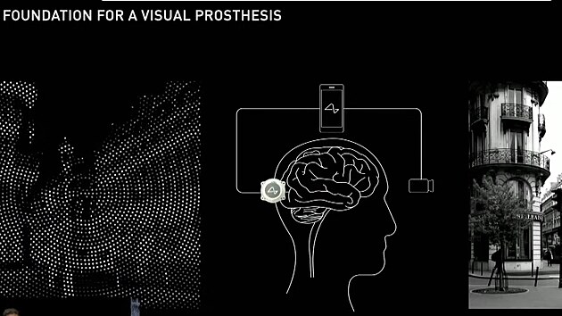 Jak by se v pedstavch vdc z Neuralinku mohl penst obraz snman kamerou do mozku pacientu, kde by se vizualizoval pomoc stimulace st, kter zpracovvaj jednotliv body obrazu.