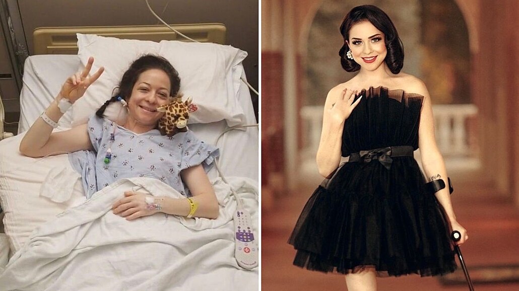 �ena je po amputaci nohy a �iví se jako modelka.