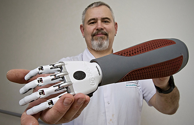 Robotická protéza z 3D tisku? Na Západočeské univerzitě žádný problém