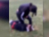 Policie prošetřuje brutální útok na dívku v Ústí