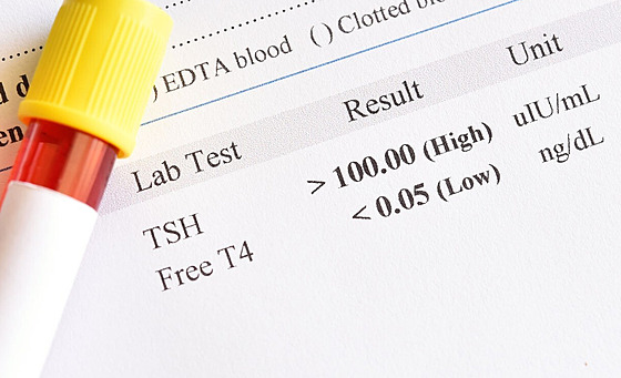 ilustra�ní snímek