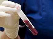 Ilustra�ní fotografie