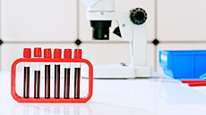 ilustra�ní snímek