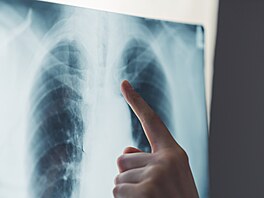 Ilustra�ní fotografie