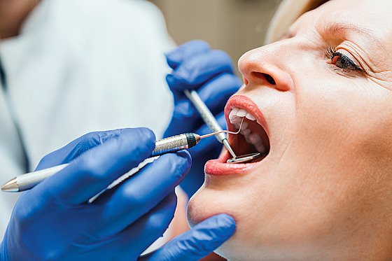 Podstatnou souástí pée o zdraví zub jsou i pravidelné prohlídky u zubního...