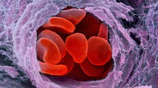 Ilustra�ní fotografie