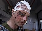 Zranný ukrajinský voják Oleg eká na evakuaci v Doncké oblasti na Ukrajin....