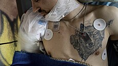 Zraněný ukrajinský voják Oleksandr leží na lůžku ve speciálním zdravotnickém... | na serveru Lidovky.cz | aktuální zprávy