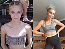 Magdal�na Kr�tk� si pro�la bulimi�, z�chvatovit�m p�ej�d�n�m a ortorexi�. Nyn�...