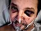 Jeremy Renner na zábrech z nemocnice po nehod v interview herce a Diane...
