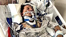 Jeremy Renner na zábrech z nemocnice po nehod v interview herce a Diane...