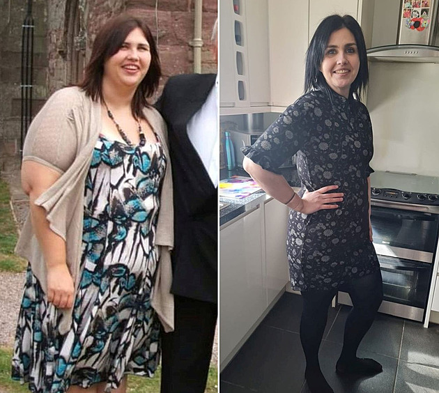 Žena zhubla pětačtyřicet kilo, změnilo jí to život