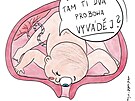Mýty v gynekologii: sex v thotenství