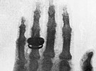 Jedna z prvních rentgenových fotografií. Ruka manelky Conrada Roentgena (23....