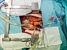 Na pstrojch lze nacviovat operaci srdce za rznch okolnost, a to bez...