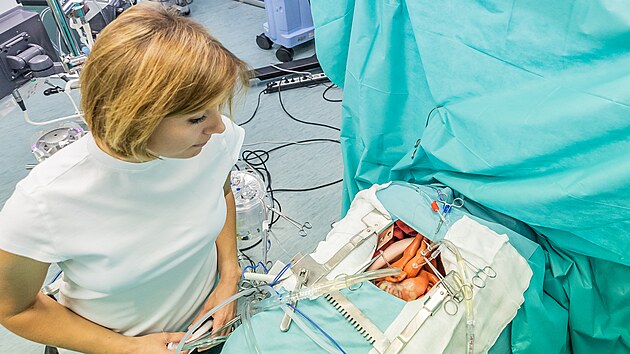 Lékařská fakulta v Hradci Králové otevřela Simulační centrum pro mimotělní oběh a terapii ECMO. Technika poslouží při doškolování kardiologů a výuku mediků.