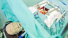 P�ístroj ECMO umí nahradit funkci srdce a plic.