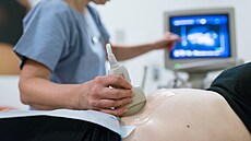 Těhotenský ultrazvuk (26. května 2023)