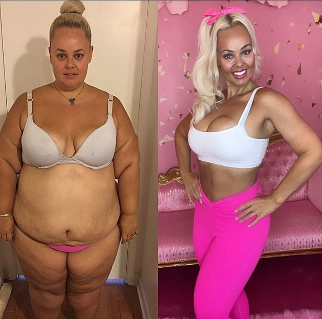 Zhubla 88 kilogramů, dnes ženu přirovnávají k Barbie