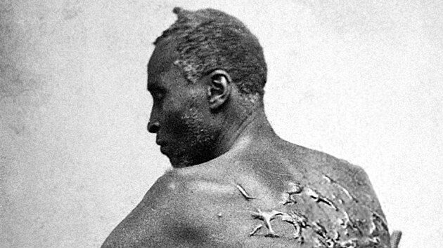 Slavná fotografie otroka Gordona, na níž ukazuje jizvy, které mu na zádech...