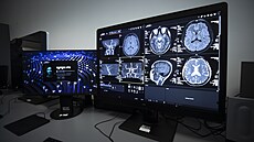 Fakultní nemocnice Královské Vinohrady (FNKV) zahájila provoz nového p�ístroje...