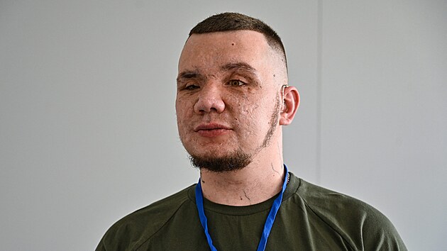 Ukrajinsk enista Vladyslav Jeenko, kter pi explozi 
miny v Bachmutu piel o zrak (23. ervna 2023)