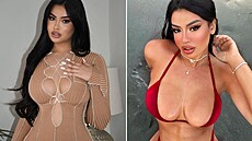 Julia Medeirosová chce vypadat jako Kylie Jennerová.