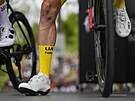 Noha britského cyklisty Adama Yatese (UAE), prbného lídra Tour de France,...