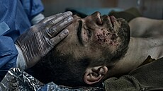Ukrajintí zdravotníci se snaí pomoci zranným vojákm. (9. dubna 2023)