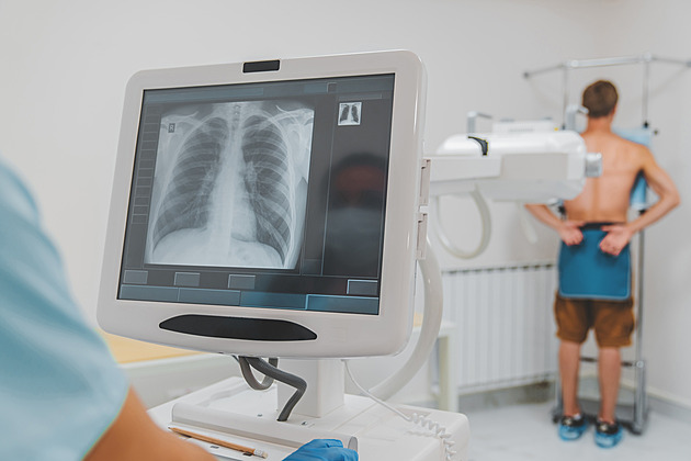 Některé rentgeny v Česku zůstávají zavřené. Je málo radiologických asistentů