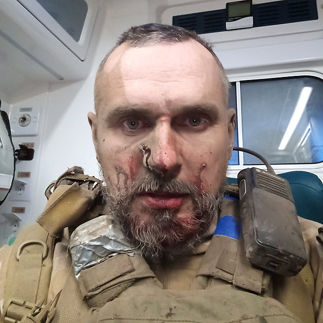Režisér Sencov se v boji dostal do dělostřelecké palby, měl střepiny v obličeji
