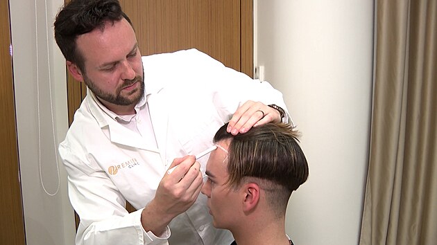 Specialista na vlasov transplantace doktor Adam Krsn, zakresluje novou linii vlas.