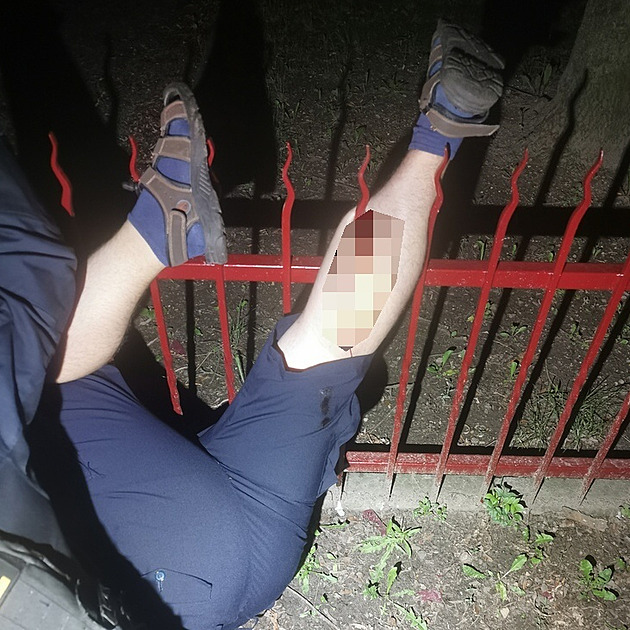 Muž si chtěl zkrátit cestu skokem přes plot, lýtkem se napíchl na ostrý hrot