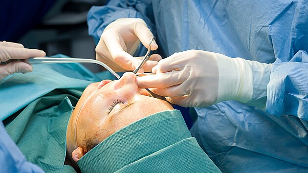 plastick chirurgie chirurg operace oparen stl