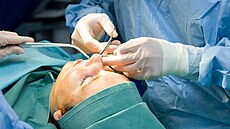 plastická chirurgie chirurg operace opareční stůl