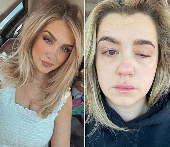 Zákrok nedopadl podle o�ekávání.