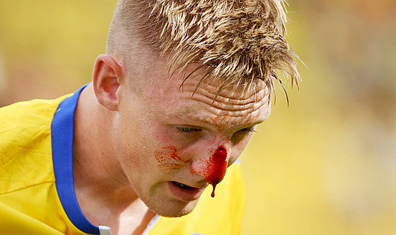Teplický tpán Chaloupek utrpl krvavý rám v zápase s Pardubicemi.