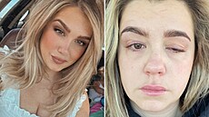 Zákrok nedopadl podle o�ekávání.