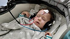 Dvouletý Martin trpí vzácným syndromem AADC, kvůli kterému je zcela odkázán na...