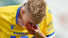 Teplický tpán Chaloupek utrpl krvavý rám v zápase s Pardubicemi.