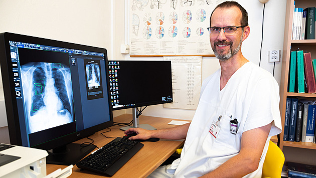 Se čtením rentgenů v Šumperku pomáhá umělá inteligence, postupně se zlepšuje