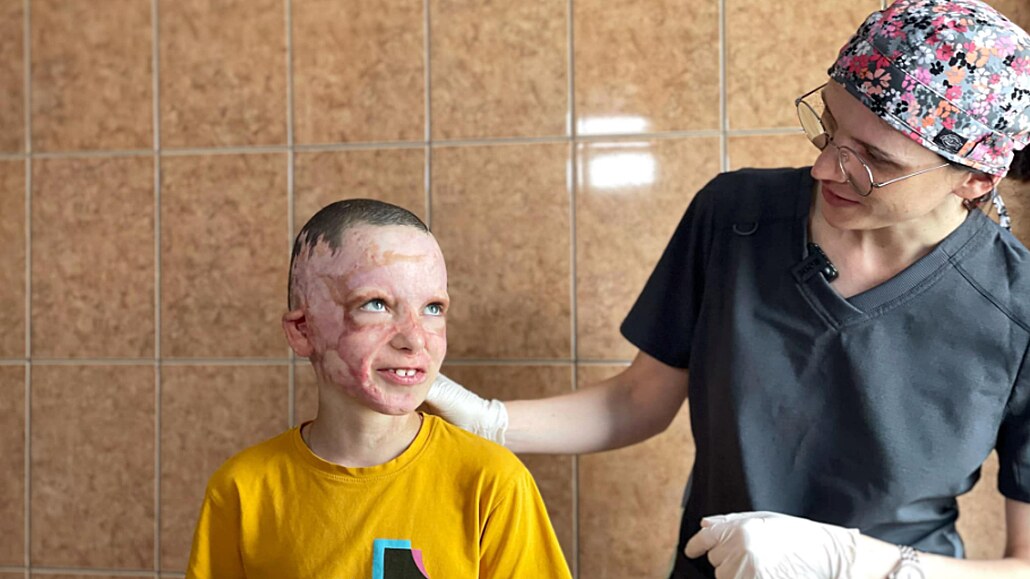 Po jednom ruském útoku utrpl ukrajinský chlapec Roman popáleniny na 45...