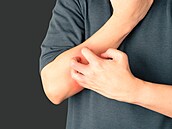 Ilustraní fotografie