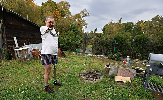 Novou ruku popálenému Jiřímu Hosovi vyrobí protetici z německého Passau