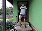 Jií Hos se po ad operací opt uí chodit s pomocí speciální protézy.