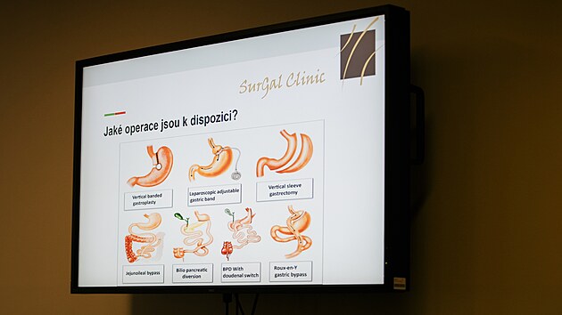 Brnnsk SurGal Clinic l operanmi zkroky komplexn metabolick poruchy, kter souvis s morbidn obezitou.
