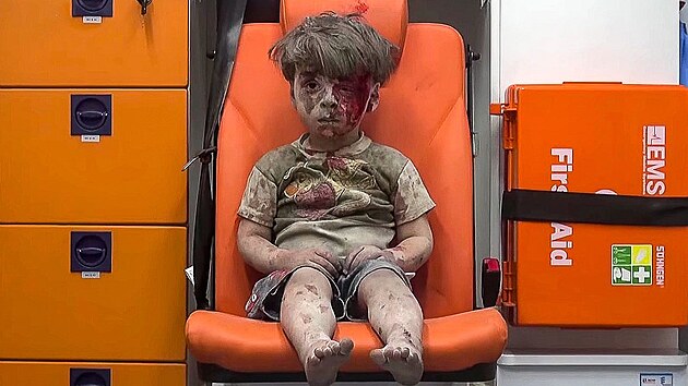 Pětiletý Umrán Dakníš se svého času stal symbolem nekončící války v Sýrii....
