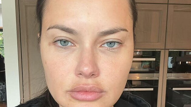 Topmodelka Adriana Lima vyvrac na Instagramu spekulace o tom, e prodlala plastiku oblieje (listopad 2023).